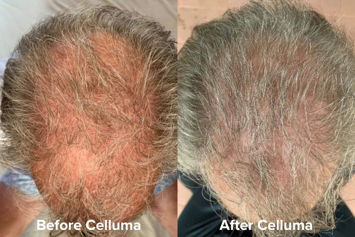 Celluma Restore